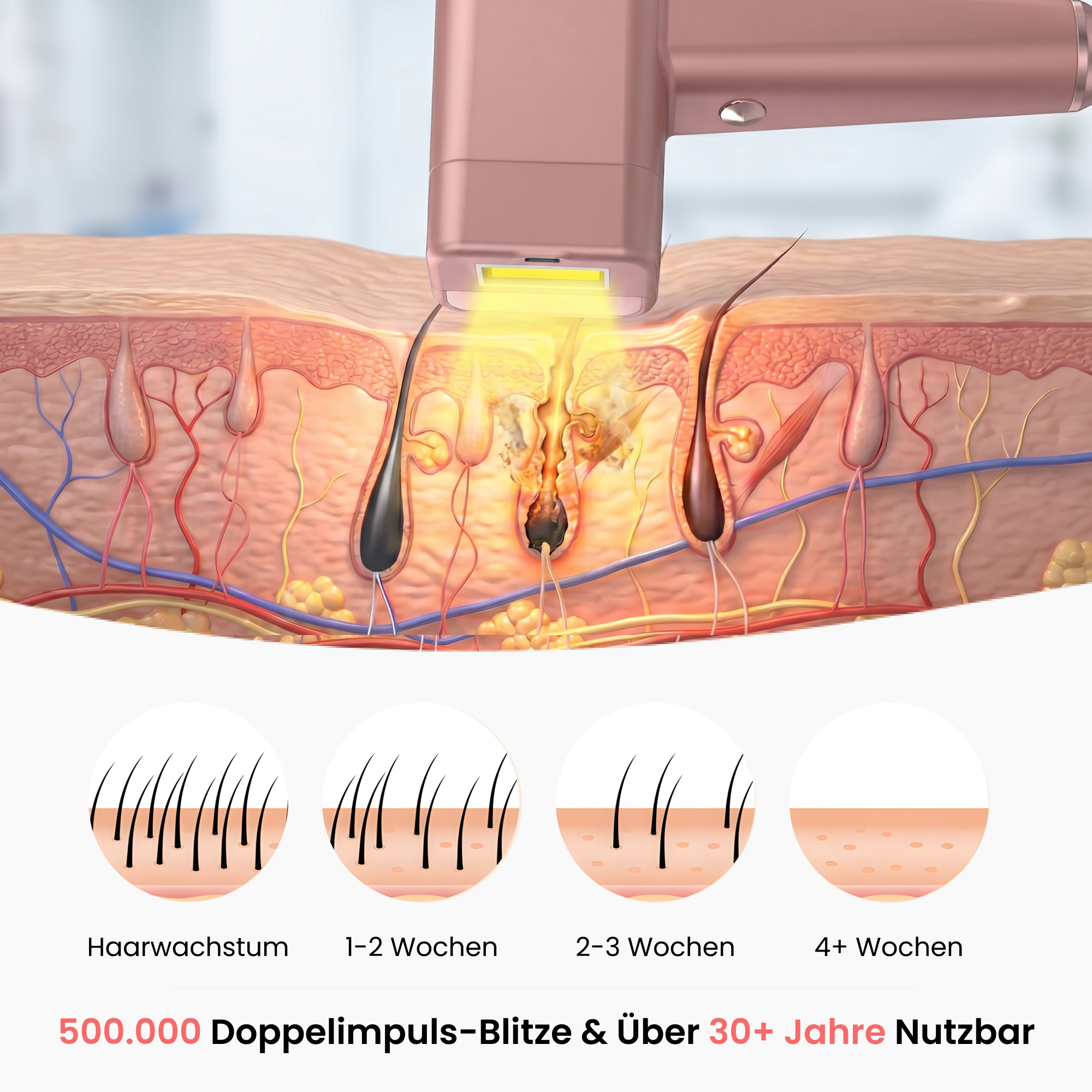 shinie IPL 3.0 PRO Bundle