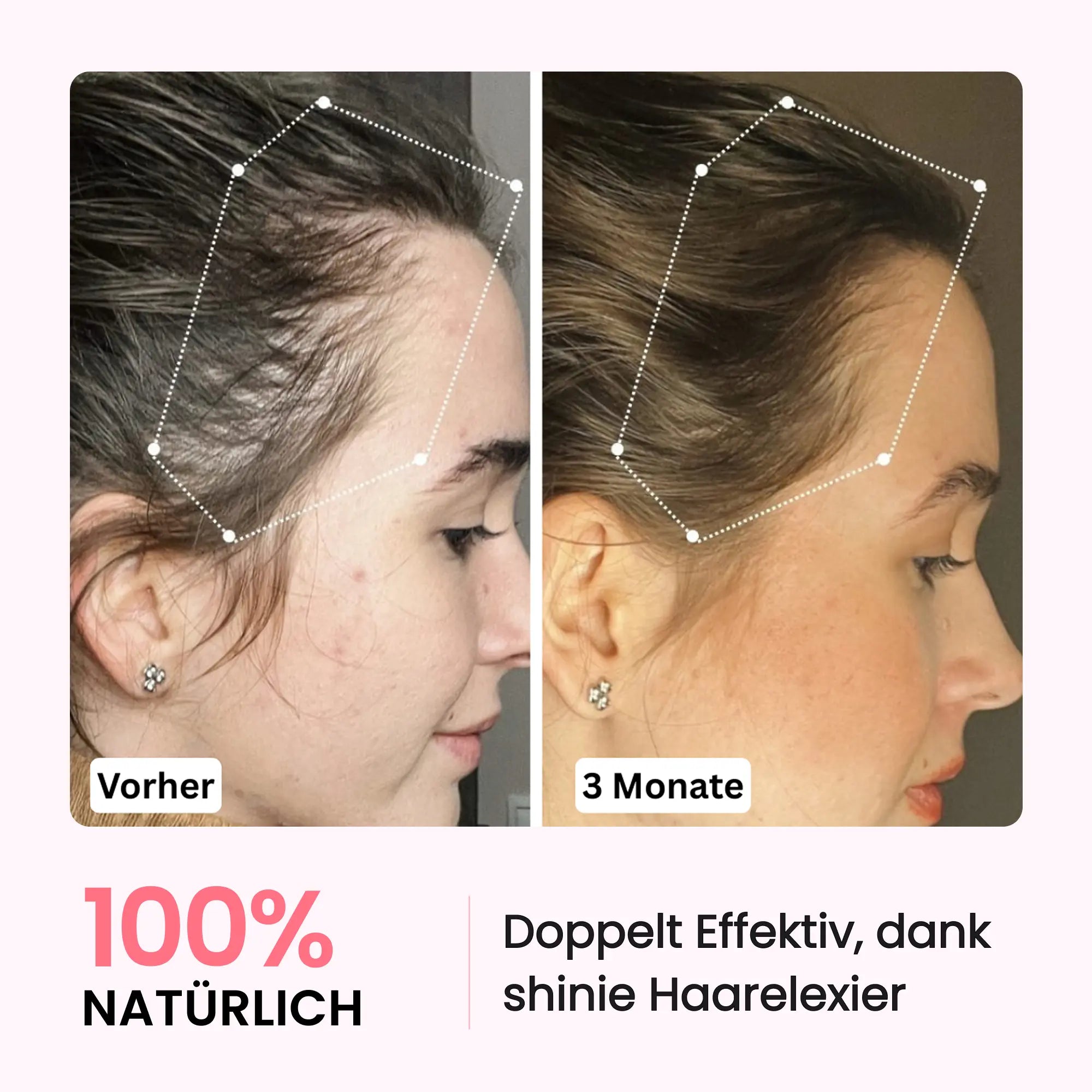 HairBoost Starterset shinie