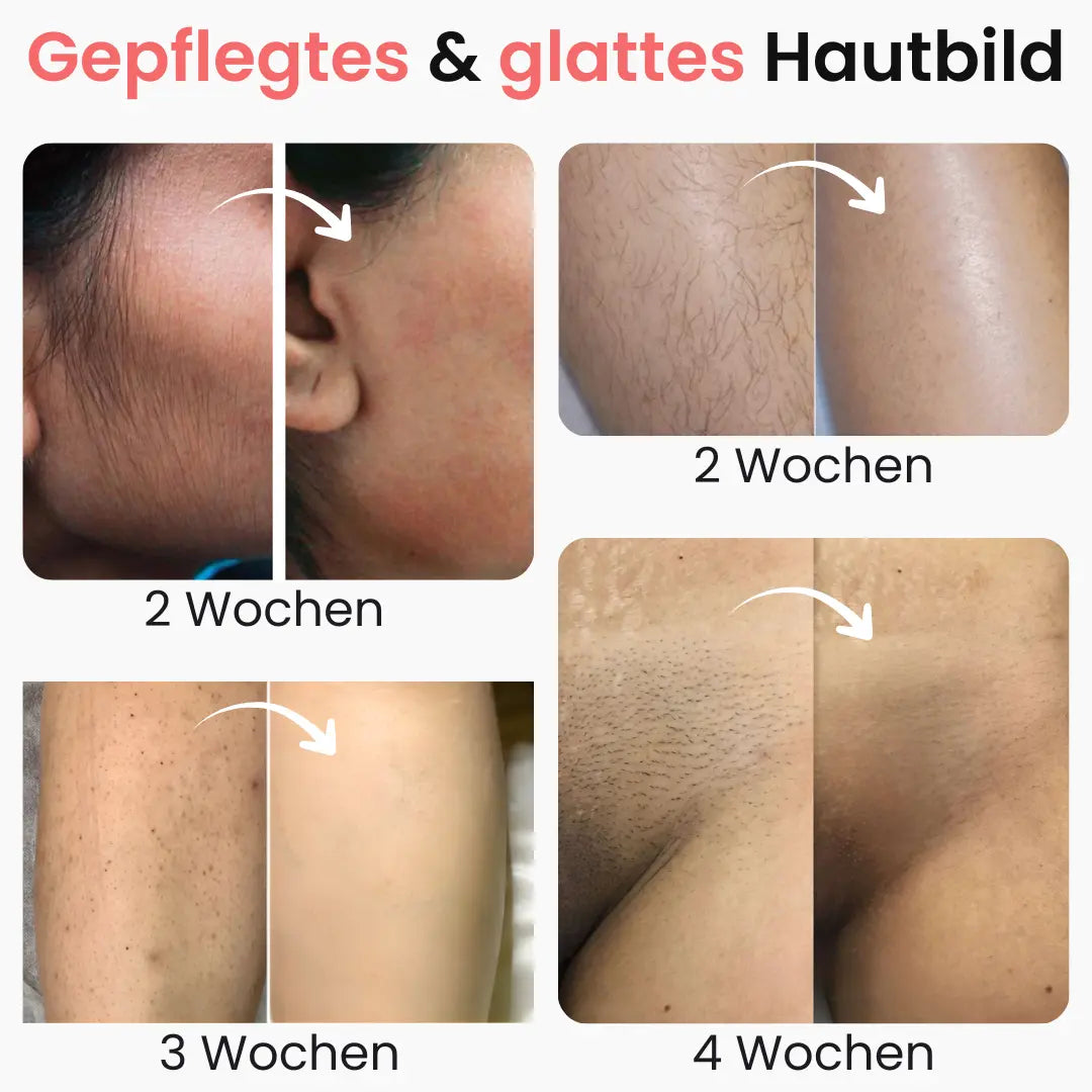 Premium Haarfrei Bundle shinie