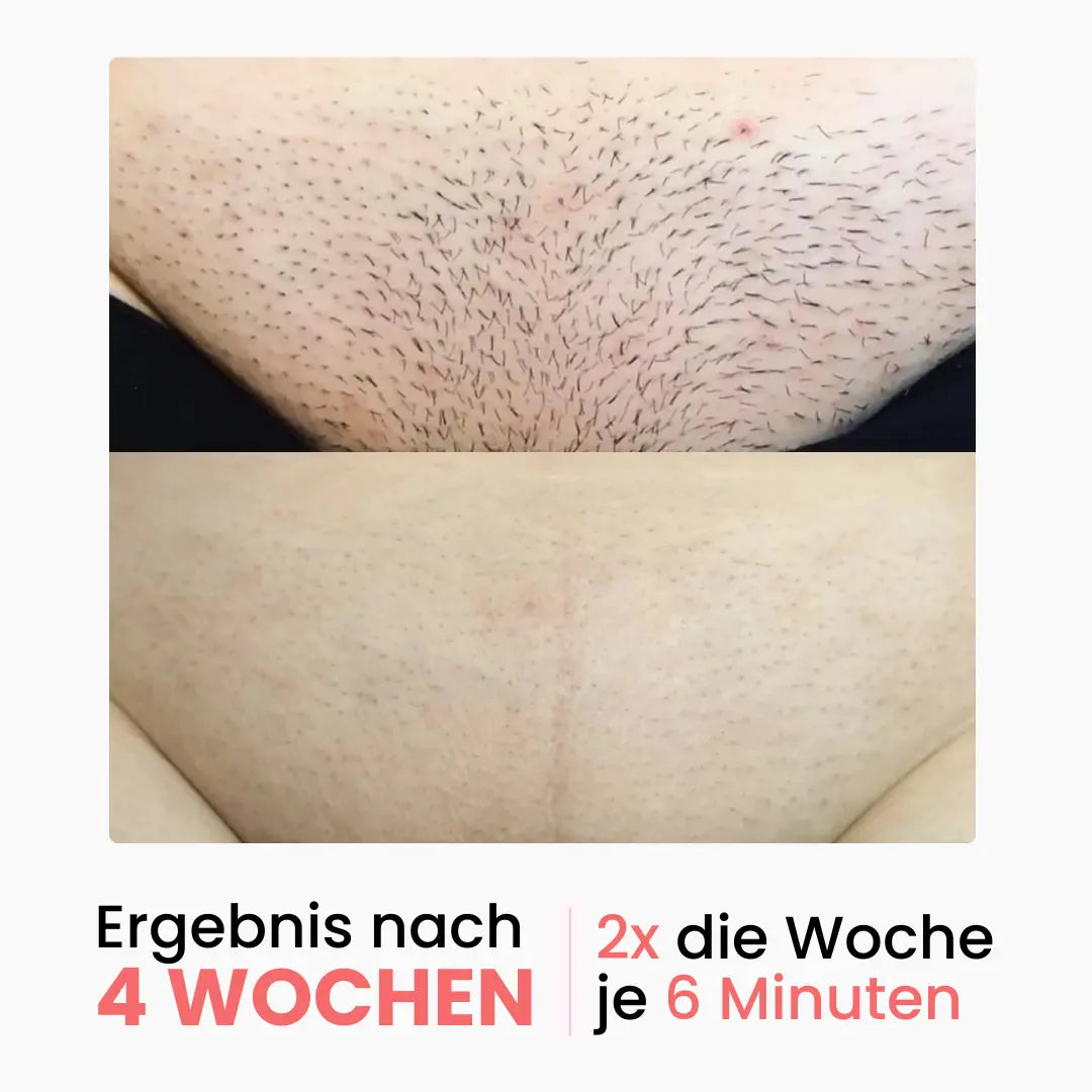 Premium Haarfrei Bundle shinie