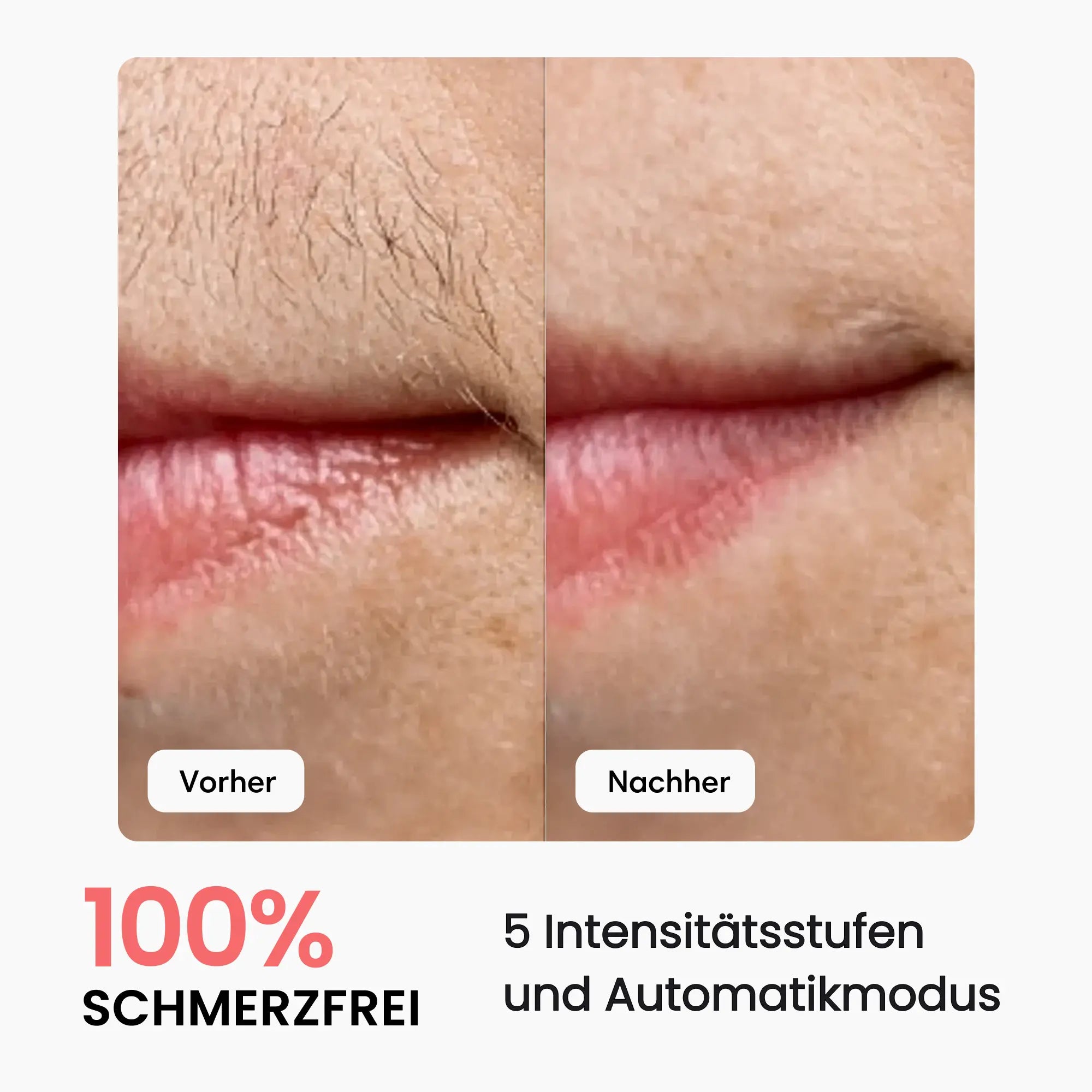 Premium Haarfrei Bundle shinie